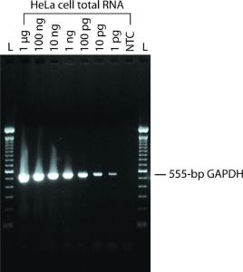 M-MLV reverse transcriptase