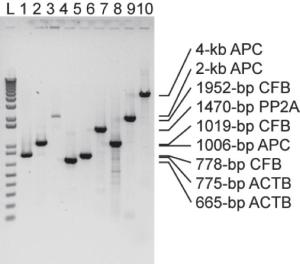 1-Step RT-PCR of varying length fragments from HeLa cell total RNA